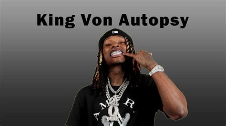 King Von: Autopsy Photos Surface Online