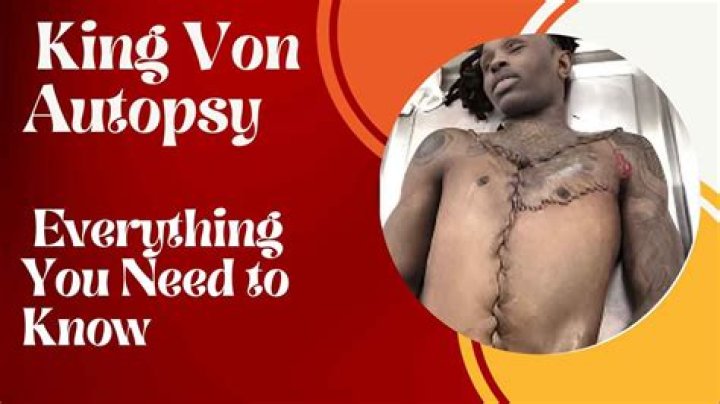 King Von Autopsy Report: Unveiling The Mystery Behind His Untimely Demise