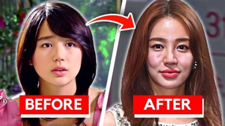 Korean Actress Plastic Surgery Gone Wrong: The Untold Stories