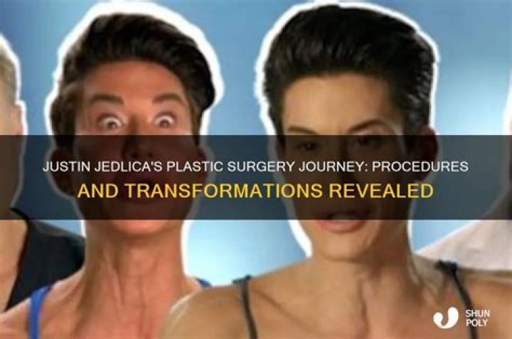 Transformations And Triumphs: The Journey Of Justin Jedlica Before And After